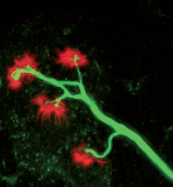 ALS: Uncovering the Common CauseScientists get closer to understanding the root cause of Lou Gehrig’s disease