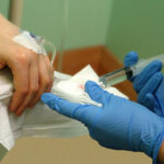 A patient receives chemotherapy treatment