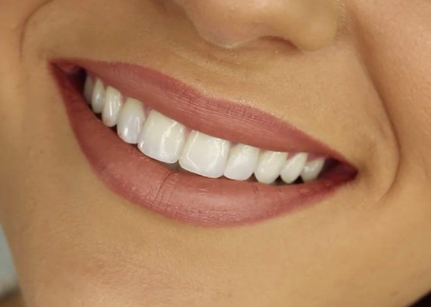 Brush Up on Dental Health: Researchers Link Unhealthy Mouths to Heart DiseaseOral inflammation might be a factor in a number of diseases
