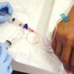 Healthcare worker injecting cyclophasphamide into a cancer patient's hand
