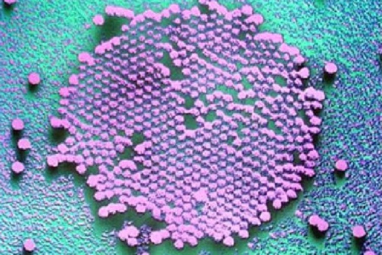 elarged snapshot of the poliovirus on a slide