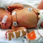 A baby in intensive care is one of American children who may not see adulthood