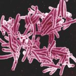 Mycobacterium tuberculosis causes XDR TB