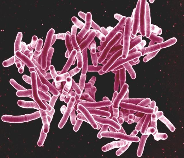 Science Strikes a Blow Against Deadly Strain of TB