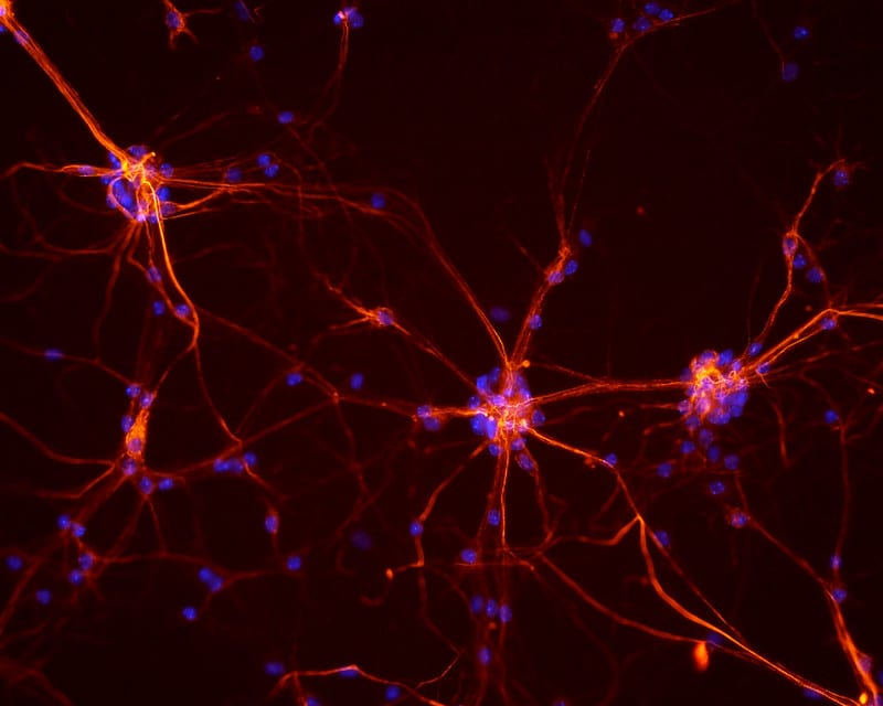 A 3D map of the heart's nervous system shows neuron activity