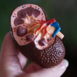 Kidney Cross Section