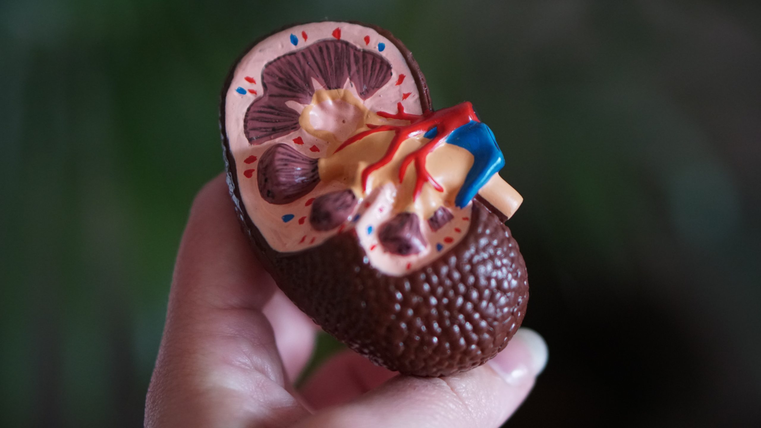 Kidney Cross Section