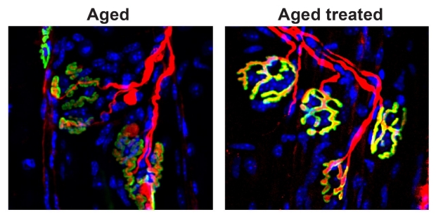comparison of treated and untreated aging muscles and nevrves
