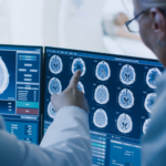 Two doctors are looking over brain scans on the computer